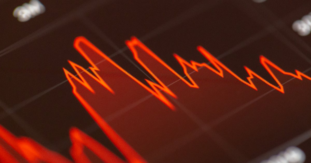 Market Data Analysis with AI: From Raw CSV to Actionable Trade Ideas